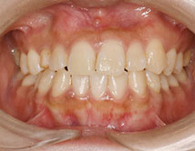 見た目はキレイな口