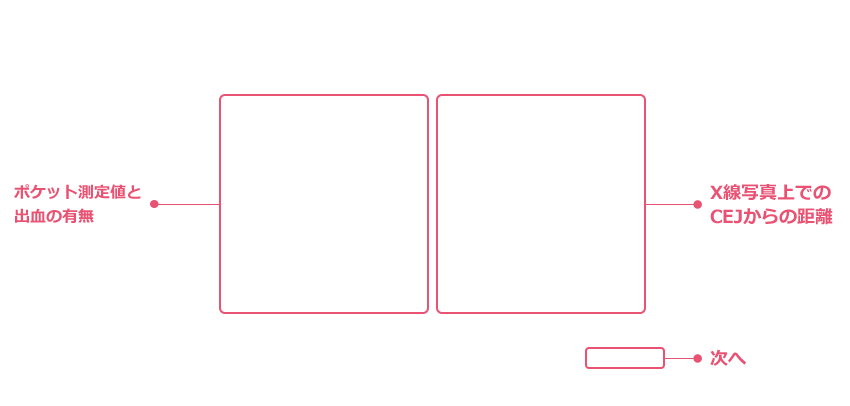 ポケット測定値と出血の有無・X線写真上でのCEJからの距離、次へ